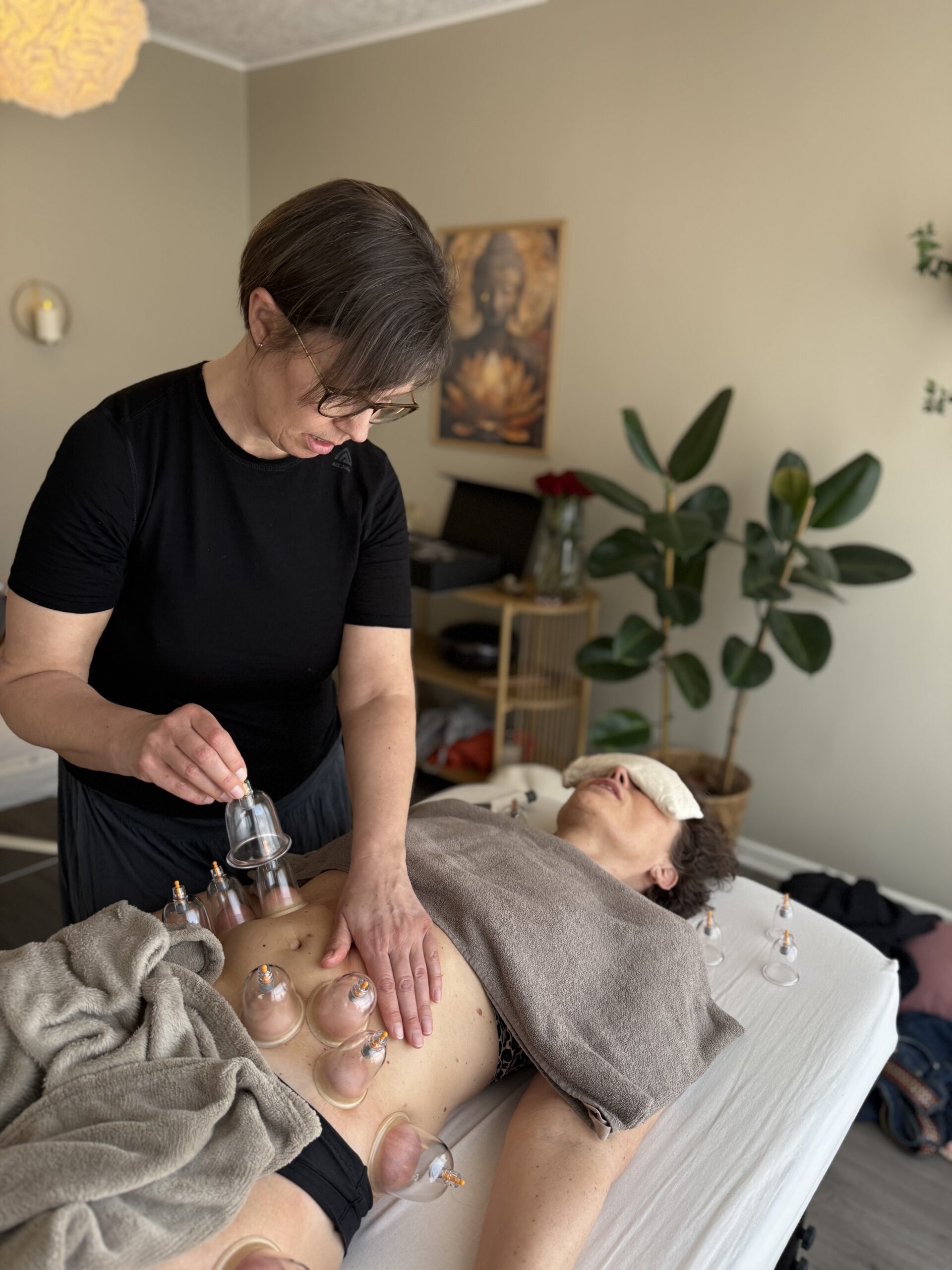cupping_v2_8